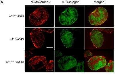 Immunocytochemistry/ Immunofluorescence: Cytokeratin 7 Antibody (R17-S) [NBP1-30152]