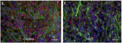 Immunohistochemistry: Cytokeratin 7 Antibody (R17-S) [NBP1-30152]