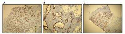 Immunohistochemistry-Paraffin: Cytokeratin 7 Antibody (R17-S) [NBP1-30152]