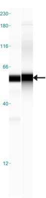Simple Western: Cytokeratin 7 Antibody [NBP1-88080]