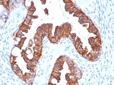 Immunohistochemistry-Paraffin: Cytokeratin 7 Antibody (rOV-TL12/30) [NBP2-53150]