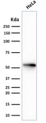 Western Blot: Cytokeratin 7 Antibody (rOV-TL12/30) [NBP2-53150]