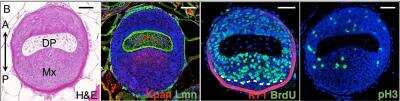 Immunocytochemistry/ Immunofluorescence: Cytokeratin 71 Antibody [NBP2-17040]