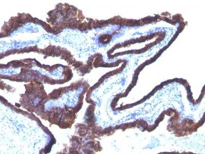 Immunohistochemistry-Paraffin: Cytokeratin 8/18 Antibody (C-43 + DC10) - Azide and BSA Free [NBP2-47982]