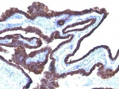 Immunohistochemistry-Paraffin: Cytokeratin 8/18 Antibody (C-43 + DC10) [NBP2-44925]