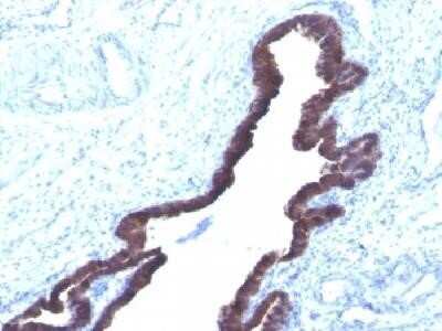 Immunohistochemistry-Paraffin: Cytokeratin 8/18 Antibody (K8.8 + DC10) - IHC-Prediluted [NBP2-44927]