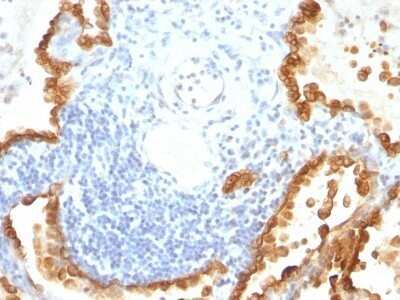 Immunohistochemistry-Paraffin: Cytokeratin 8/18 Antibody (KRT8/803 + KRT18/835) - Azide and BSA Free [NBP2-47983]