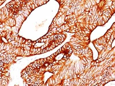 Immunohistochemistry-Paraffin: Cytokeratin 8/18 Antibody (KRT8/803 + KRT18/835) [NBP2-44930]