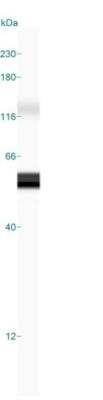Simple Western: Cytokeratin 8/18 Antibody (KRT8/803 + KRT18/835) [NBP2-44930]