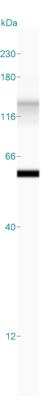 Simple Western: Cytokeratin 8/18 Antibody (KRT8/803 + KRT18/835) [NBP2-44930]