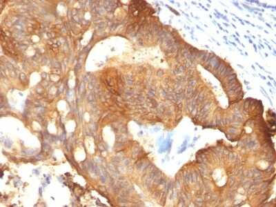 Immunohistochemistry-Paraffin: Cytokeratin 8 Antibody (B22.1) [NBP2-44931]