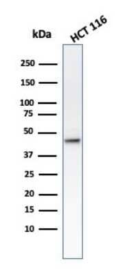 Western Blot: Cytokeratin 8 Antibody (B22.1) [NBP2-44931]