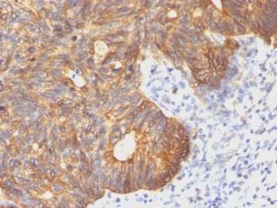 Immunohistochemistry-Paraffin: Cytokeratin 8 Antibody (C-43) [NBP2-44938]