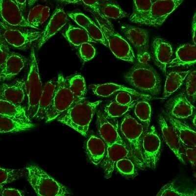 Immunocytochemistry/ Immunofluorescence: Cytokeratin 8 Antibody (H1+TS1) - Azide and BSA Free [NBP2-34627]