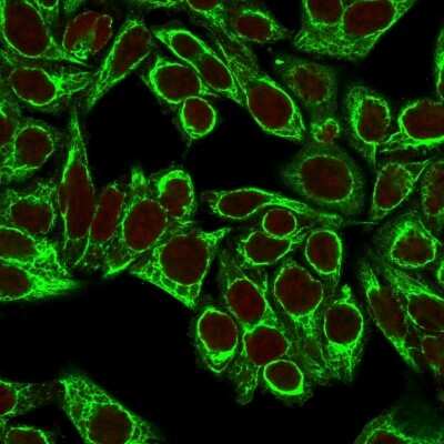 Immunocytochemistry/ Immunofluorescence: Cytokeratin 8 Antibody (H1+TS1) [NBP2-34268]