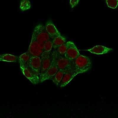 Immunocytochemistry/ Immunofluorescence: Cytokeratin 8 Antibody (H1+TS1) [NBP2-34268]