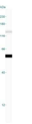 Simple Western: Cytokeratin 8 Antibody (H1)Azide and BSA Free [NBP2-34626]