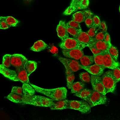 Immunocytochemistry/ Immunofluorescence: Cytokeratin 8 Antibody (H1) [NBP2-34265]