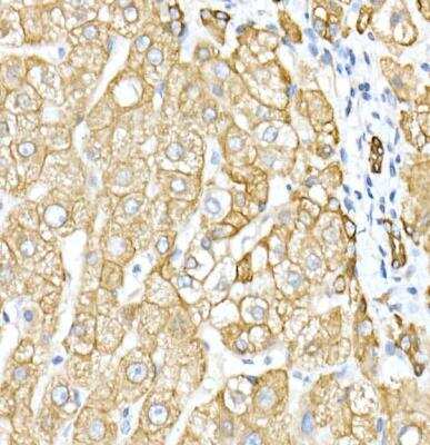 Immunohistochemistry-Paraffin: Cytokeratin 8 Antibody - Azide and BSA Free [NBP2-92958]