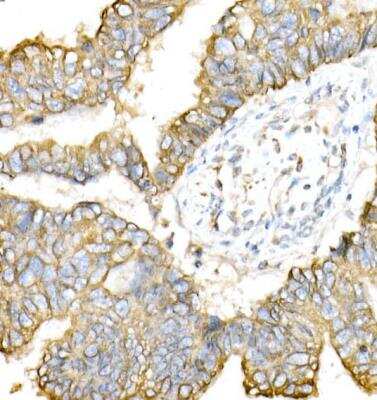 Immunohistochemistry-Paraffin: Cytokeratin 8 Antibody - Azide and BSA Free [NBP2-92958]