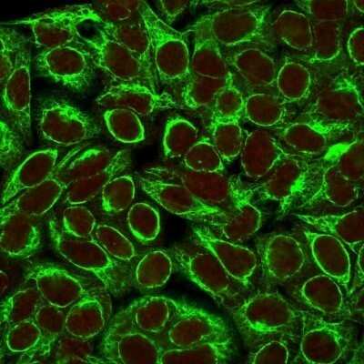 Immunocytochemistry/ Immunofluorescence: Cytokeratin 8 Antibody (K8/383) - Azide and BSA Free [NBP2-34656]