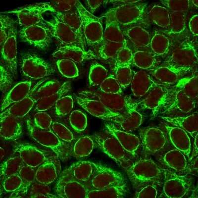 Immunocytochemistry/ Immunofluorescence: Cytokeratin 8 Antibody (K8/383) [NBP2-34266]