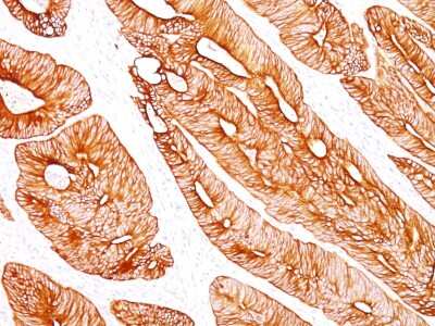 Immunohistochemistry-Paraffin: Cytokeratin 8 Antibody (K8/383) [NBP2-34266]