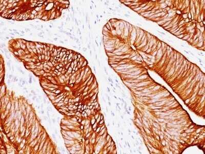 Immunohistochemistry-Paraffin: Cytokeratin 8 Antibody (K8.8) - Azide and BSA Free [NBP2-34654]