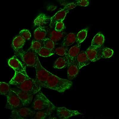 Immunocytochemistry/ Immunofluorescence: Cytokeratin 8 Antibody (K8.8) [NBP2-34269]