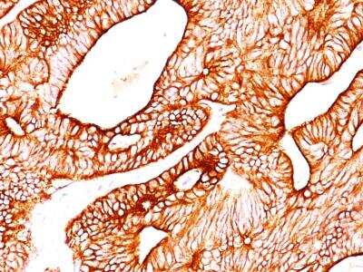 Immunohistochemistry-Paraffin: Cytokeratin 8 Antibody (K8.8) [NBP2-34269]