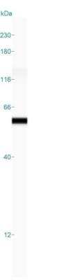 Simple Western: Cytokeratin 8 Antibody (K8.8) [NBP2-34269]