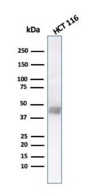 Western Blot: Cytokeratin 8 Antibody (K8.8) [NBP2-34269]