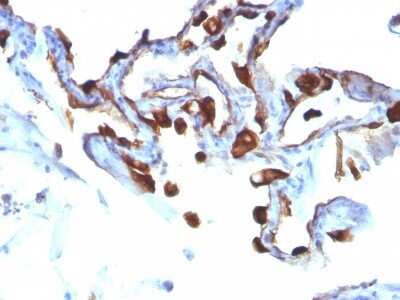 Immunohistochemistry-Paraffin: Cytokeratin 8 Antibody (KRT8/803) [NBP2-44940]