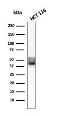 Western Blot: Cytokeratin 8 Antibody (KRT8/803) [NBP2-44940]