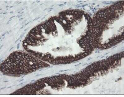 Flow Cytometry: Cytokeratin 8 Antibody (OTI1B12) - Azide and BSA Free [NBP2-71082]