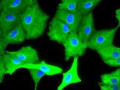 Immunocytochemistry/ Immunofluorescence: Cytokeratin 8 Antibody (OTI1B12) - Azide and BSA Free [NBP2-71082]