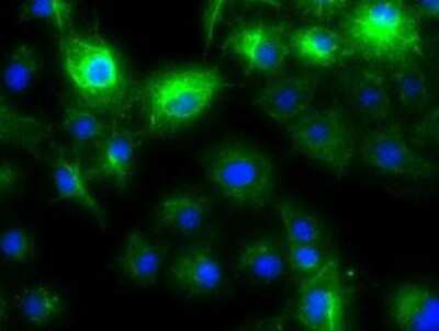 Immunocytochemistry/ Immunofluorescence: Cytokeratin 8 Antibody (OTI1B12) - Azide and BSA Free [NBP2-71082]