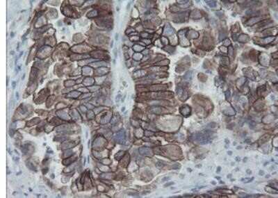 Immunohistochemistry: Cytokeratin 8 Antibody (OTI1B12) - Azide and BSA Free [NBP2-71082]