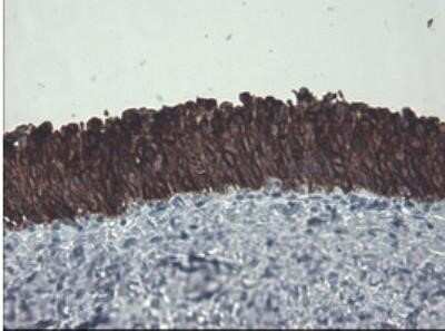 Immunohistochemistry: Cytokeratin 8 Antibody (OTI1B12) - Azide and BSA Free [NBP2-71082]
