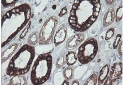 Immunohistochemistry: Cytokeratin 8 Antibody (OTI1B12) - Azide and BSA Free [NBP2-71082]
