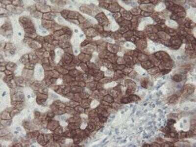 Immunohistochemistry: Cytokeratin 8 Antibody (OTI1B12) - Azide and BSA Free [NBP2-71082]