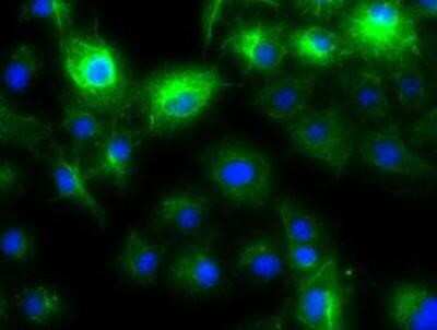 Immunocytochemistry/ Immunofluorescence: Cytokeratin 8 Antibody (OTI1B12) [NBP1-48281]