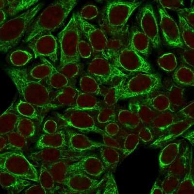 Immunocytochemistry/ Immunofluorescence: Cytokeratin 8 Antibody (SPM192) [NBP2-34352]