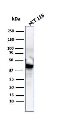 Western Blot: Cytokeratin 8 Antibody (SPM192) [NBP2-34352]