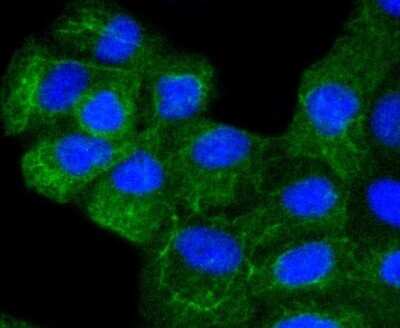 Immunocytochemistry/ Immunofluorescence: Cytokeratin 8 Antibody (SU0338) [NBP2-67468]