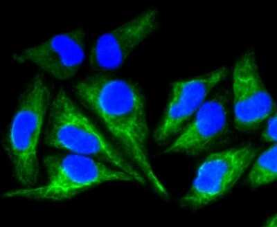 Immunocytochemistry/ Immunofluorescence: Cytokeratin 8 Antibody (SU0338) [NBP2-67468]