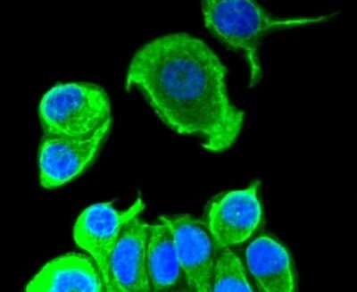 Immunocytochemistry/ Immunofluorescence: Cytokeratin 8 Antibody (SU0338) [NBP2-67468]
