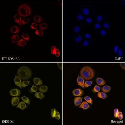 Immunocytochemistry/ Immunofluorescence: Cytokeratin 8 Antibody (SU0338) [NBP2-67468]