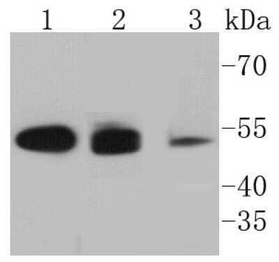 Western Blot: Cytokeratin 8 Antibody (SU0338) [NBP2-67468]