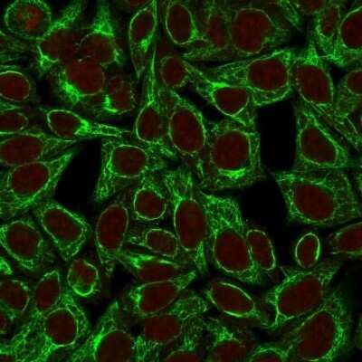 Immunocytochemistry/ Immunofluorescence: Cytokeratin 8 Antibody (TS1) - Azide and BSA Free [NBP2-34501]
